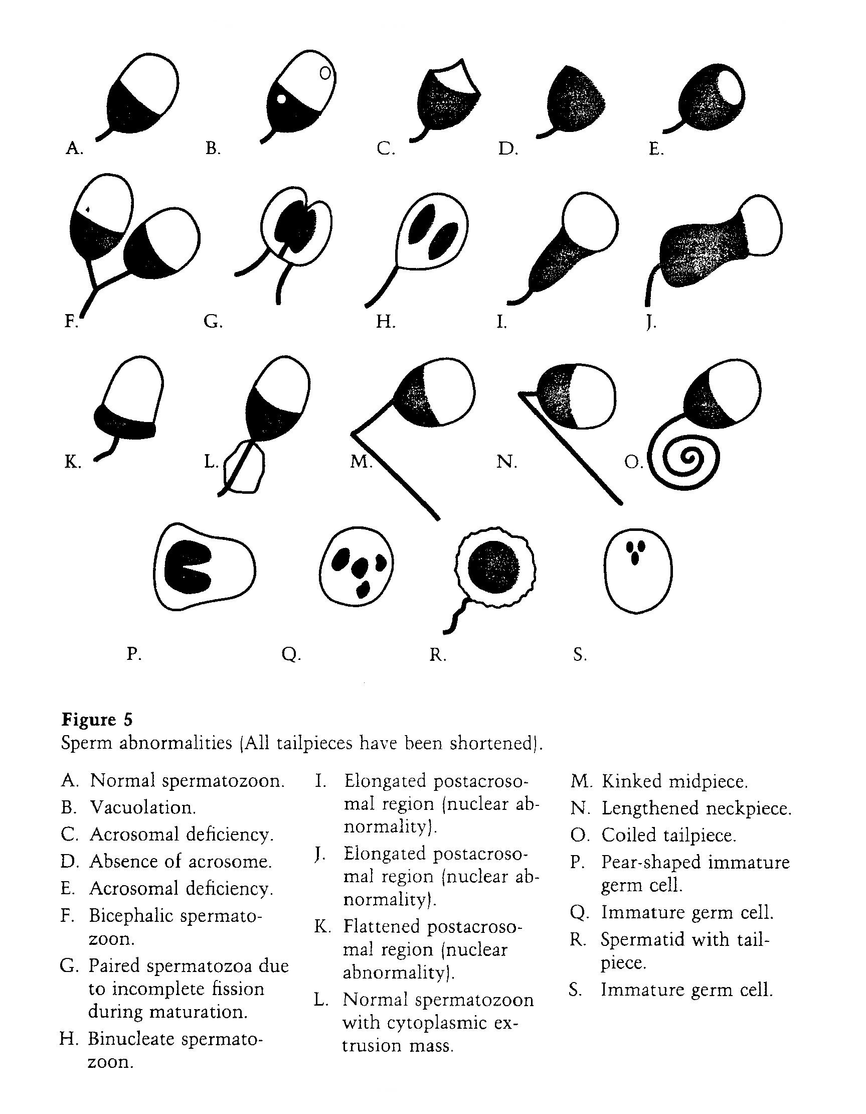 defective sperm