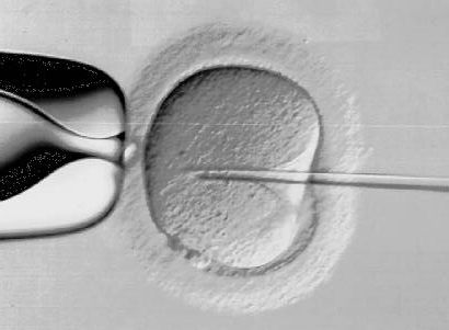 sperm injection into an egg